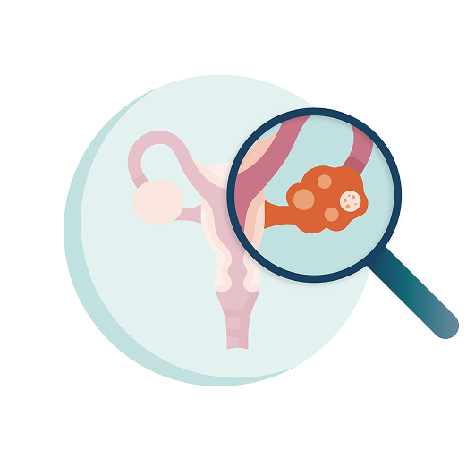 Illustration of a magnifying glass over an ovary